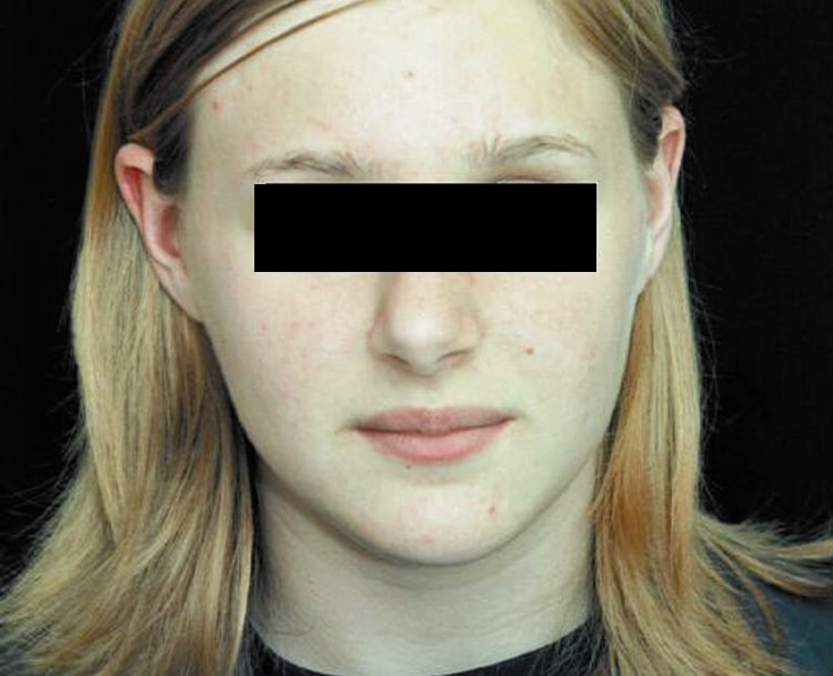 a close up of a woman with no skin spots
