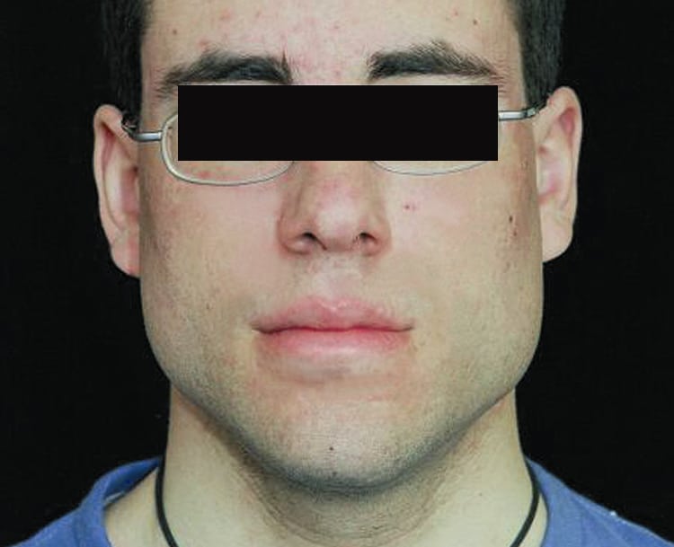 a close up of a man wearing glasses and looking at the camera with no skin spots