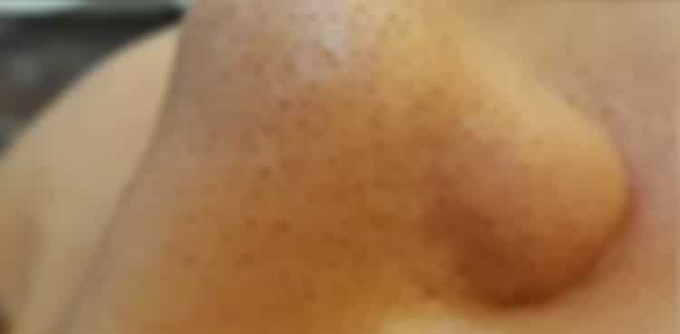 a close up of a nose