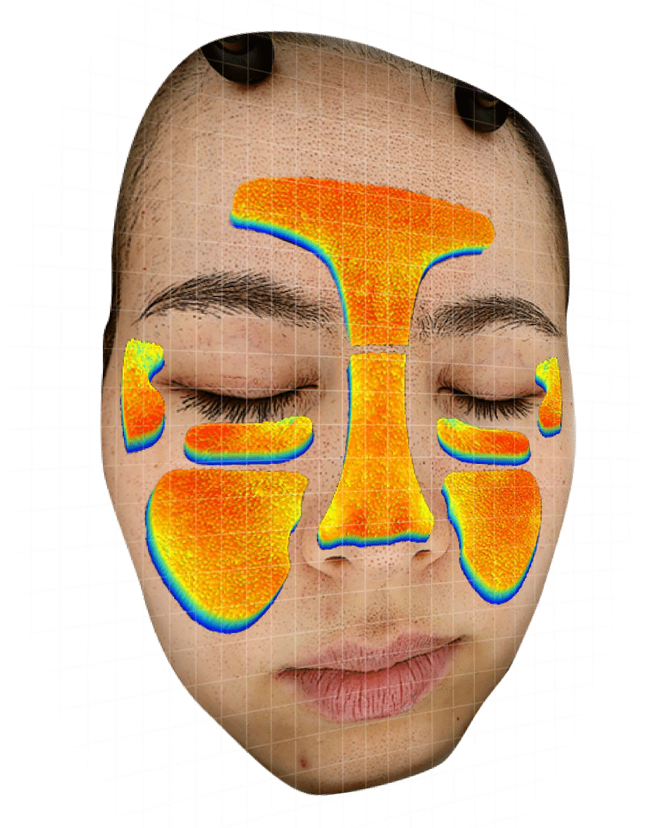 skin analysis results