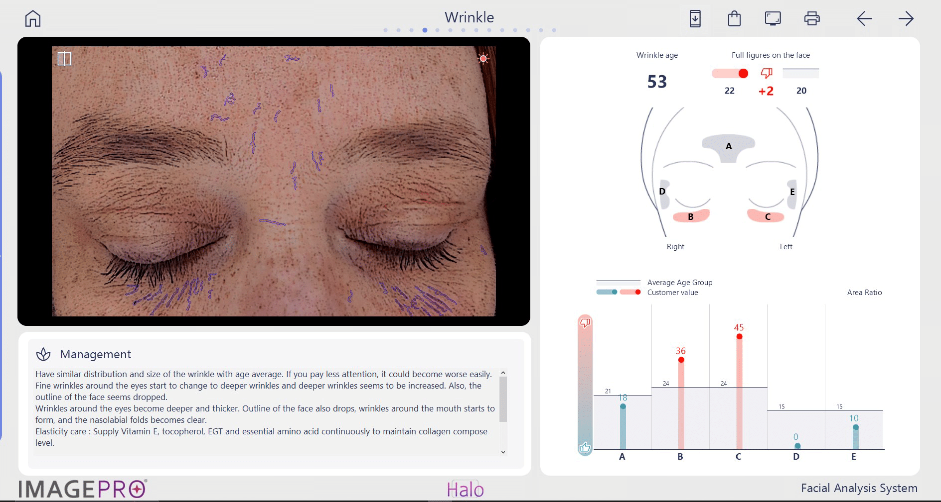 skin analysis results